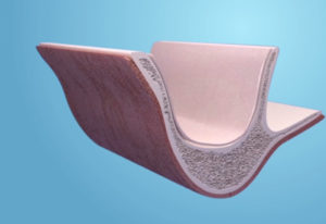 Implant dentaire 77
